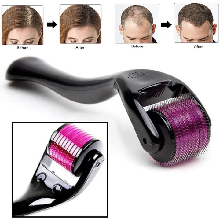 540 Needle Derma Roller for Hair & Skin